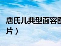 唐氏儿典型面容图片婴儿（唐氏儿典型面容图片）