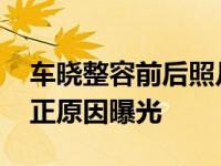 车晓整容前后照片鼻子好丑 与前夫离婚的真正原因曝光