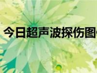 今日超声波探伤图像怎么看（超声波探鱼器）