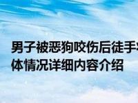 男子被恶狗咬伤后徒手将狗掐死 手臂被咬伤流血太吓人了具体情况详细内容介绍