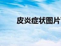 皮炎症状图片下巴（皮炎症状图片）