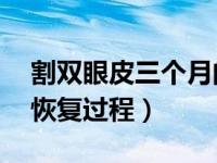 割双眼皮三个月的恢复过程（割双眼皮15天恢复过程）