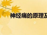 神经痛的原理及其机制（神经痛简介）