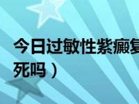 今日过敏性紫癜复发原因（过敏性紫癜复发会死吗）