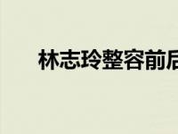 林志玲整容前后照片（林志玲污照片）
