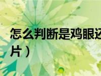 怎么判断是鸡眼还是疣（鸡眼图片挖出根部图片）