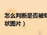 怎么判断是否被蜈蚣咬了图片（被蜈蚣咬的症状图片）
