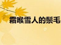 霜喉雪人的鬃毛（霜喉雪人任务怎么做）