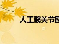 人工髋关节图（人工髋关节简介）