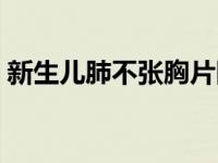 新生儿肺不张胸片图片（新生儿肺不张简介）