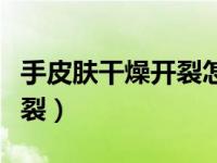 手皮肤干燥开裂怎么治疗（今日手皮肤干燥开裂）